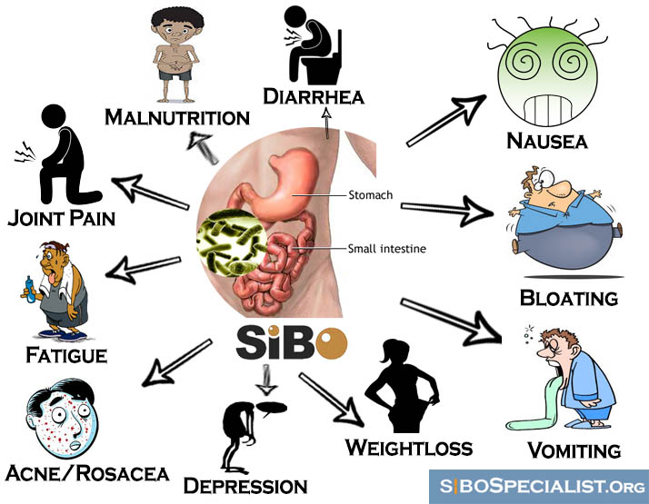 Signs & Symptoms of Sibo